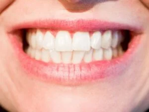 close-up of a woman's mouth and teeth