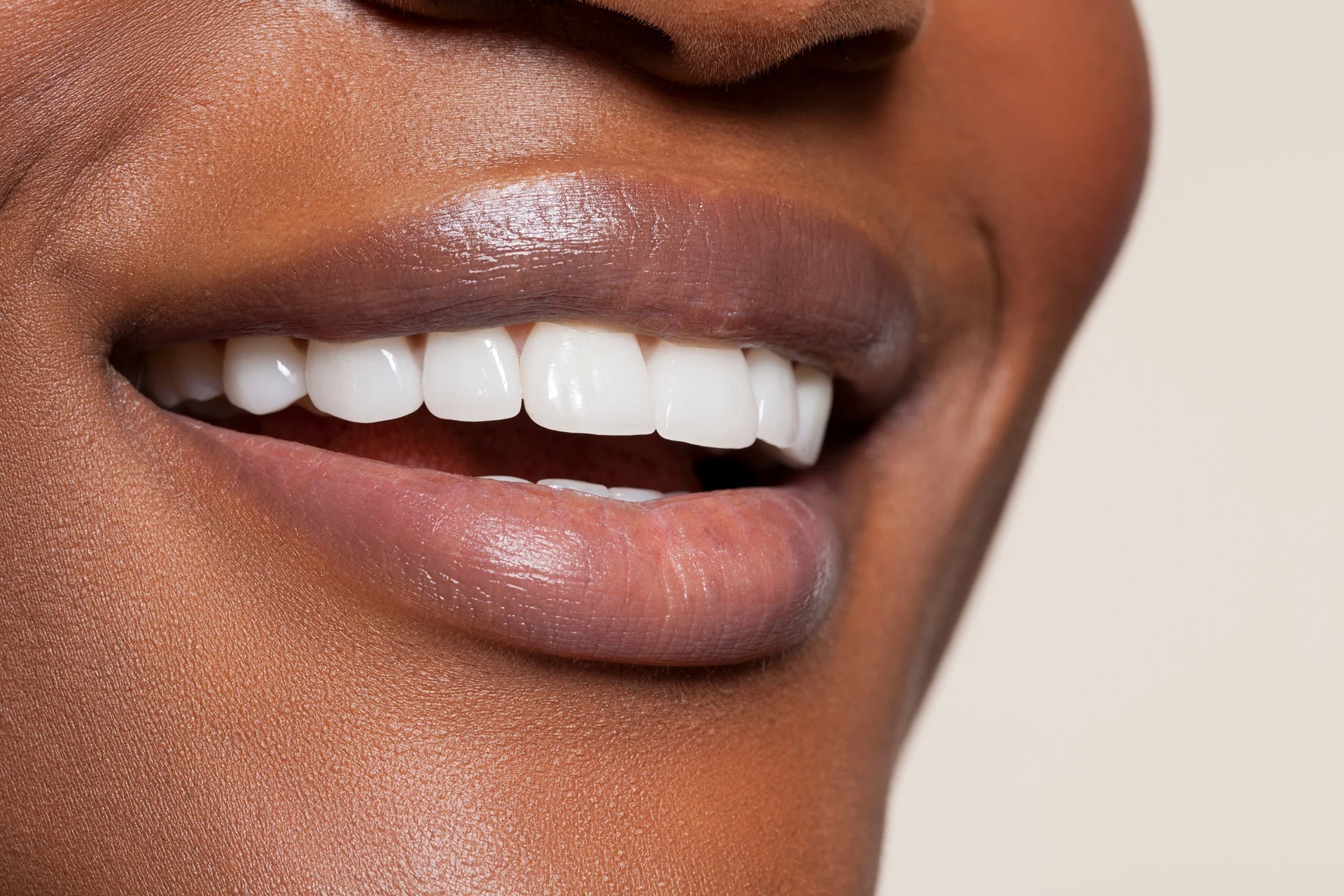 close up of a woman's mouth and teeth