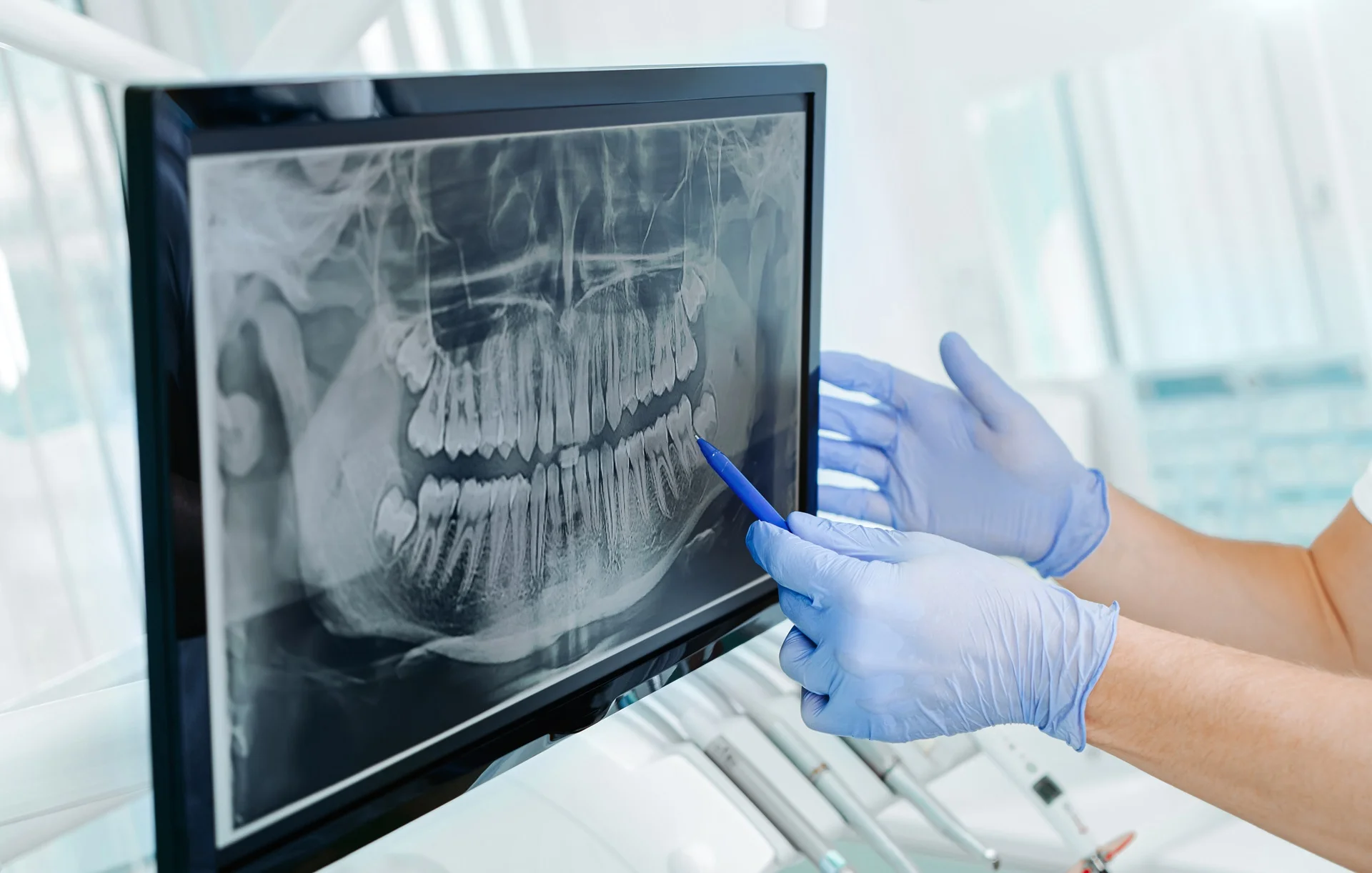 hands wearing gloves pointing at x-ray image