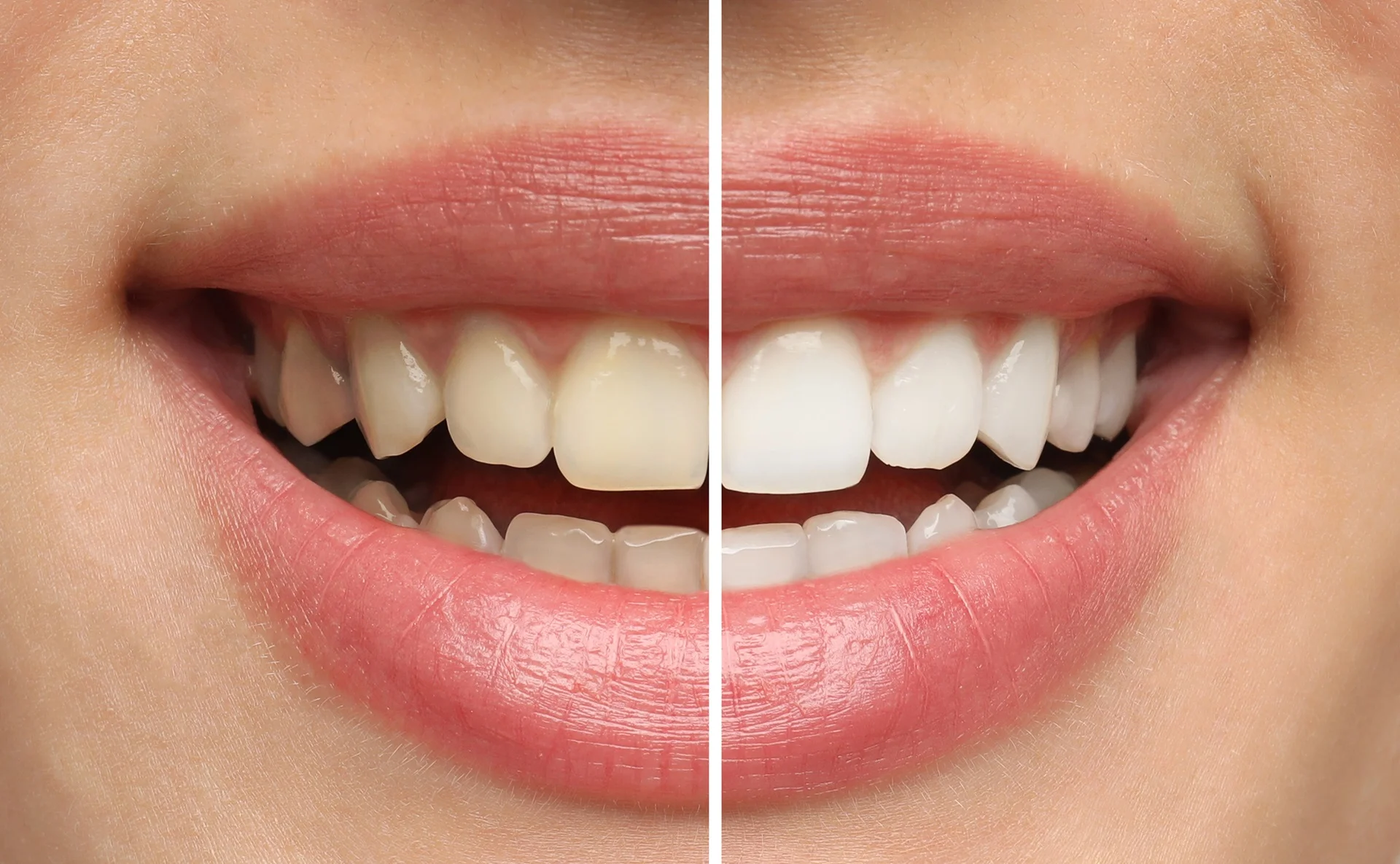 a close-up of a woman's teeth