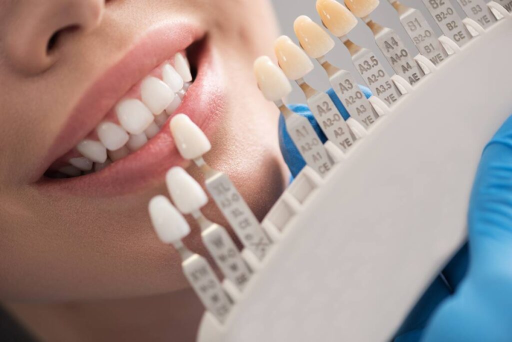 a close-up of a woman's teeth