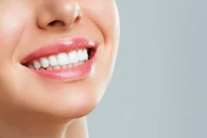 Advantages of Professional Teeth Whitening Treatment in Harrisburg, NC by Mint Dental