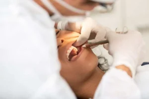 Dental Extractions in Harrisburg, NC by Mint Dental